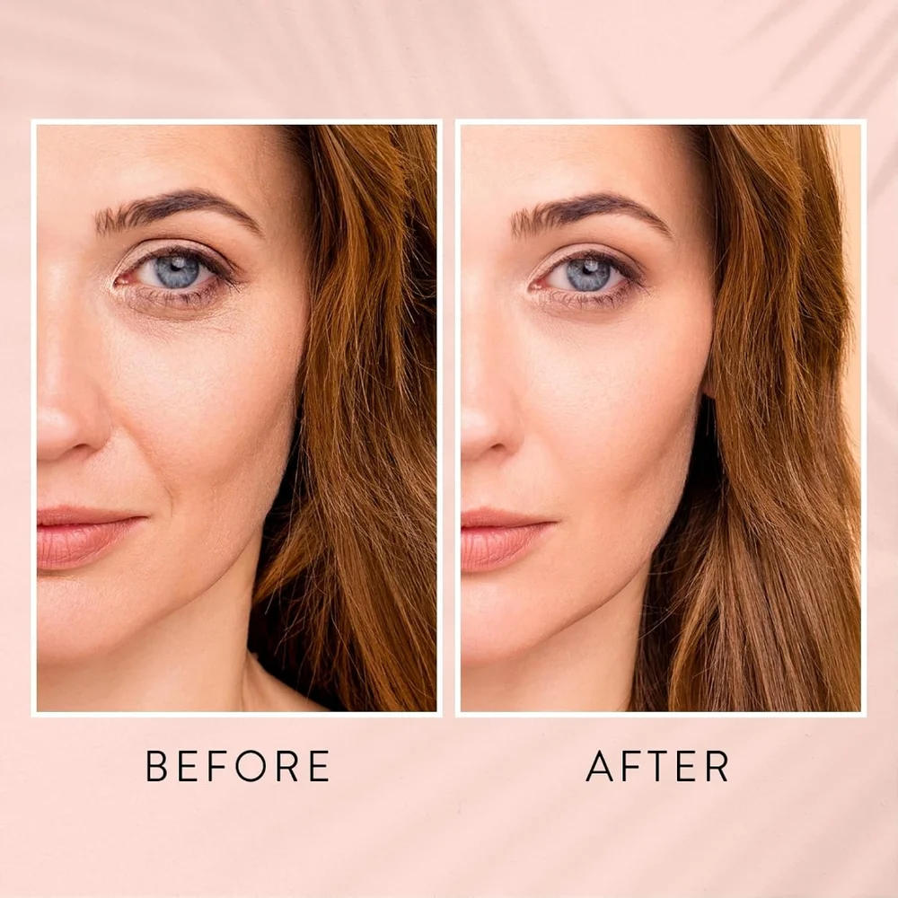 Retinol Serum for Face - for fine lines, wrinkles, dark spots - Picture 5 of 9